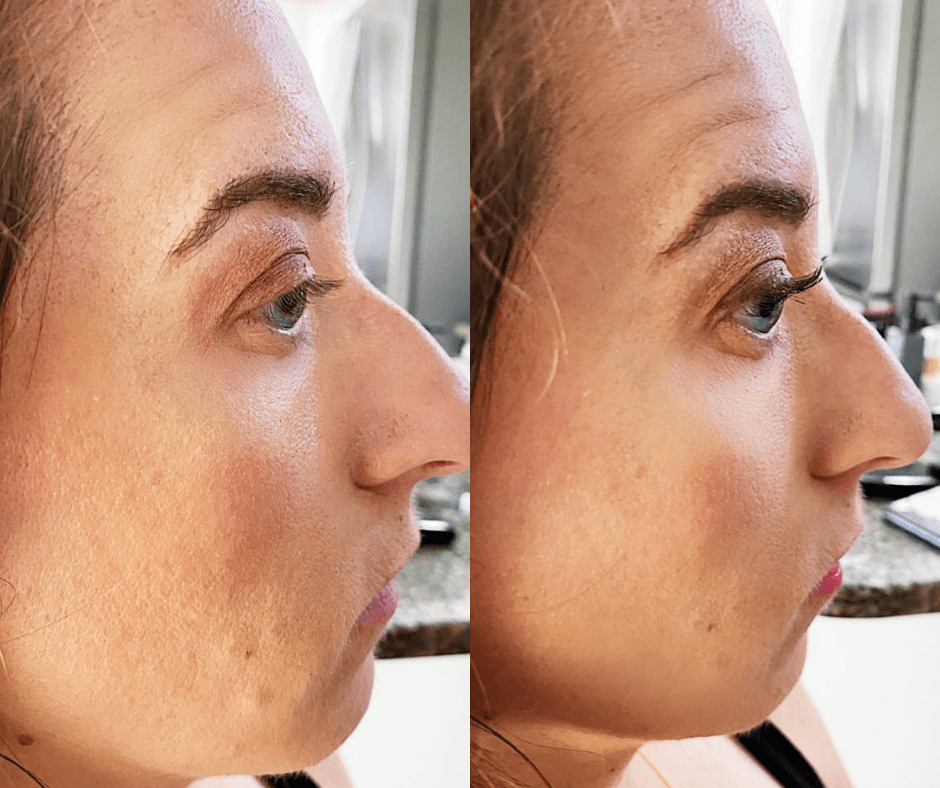 InstaCurl Heated Lash Lifter