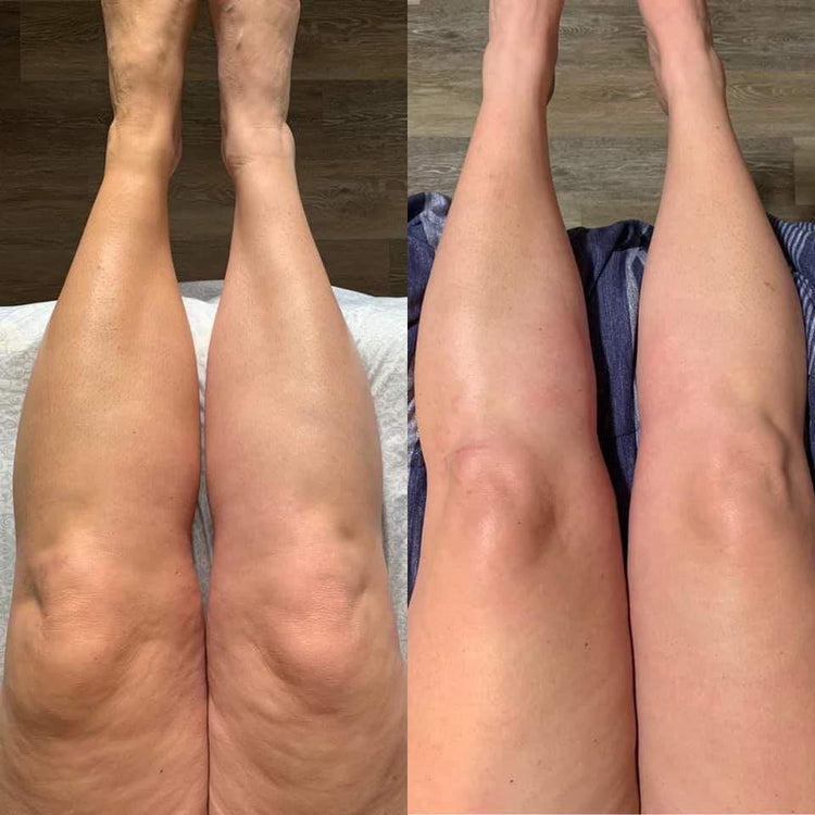 SnatchLift Pro™