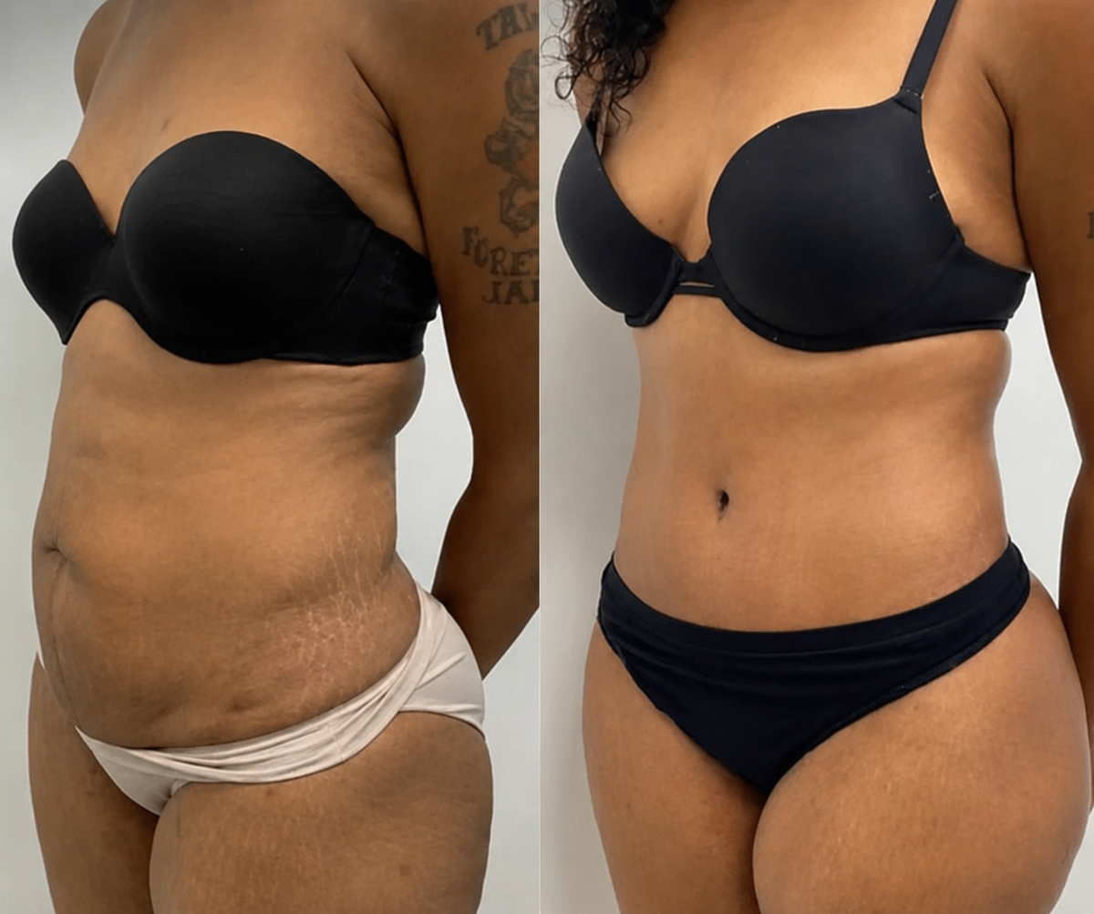 Customer before and after comparison